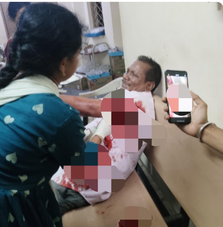 Daily Bharat దుమ్ముగూడెం లో వ్యక్తి పై హత్యాయత్నం...
