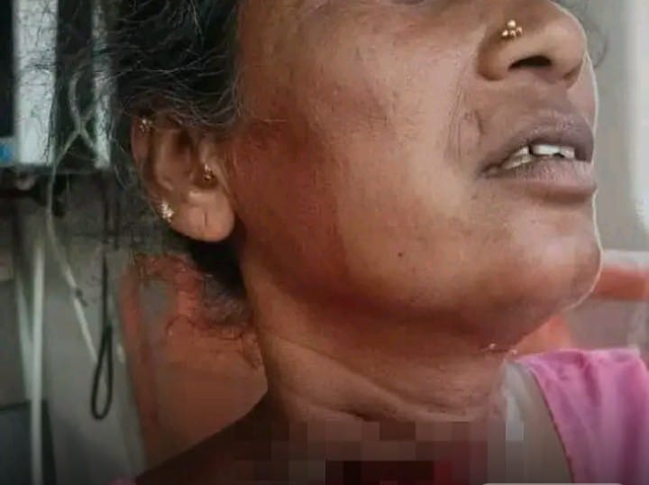కుటుంబ గొడవలతో భార్య గొంతు కోసిన భర్త