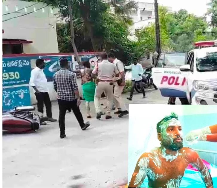 పోలీస్ స్టేషన్ ముందు నిప్పంటించుకున్న యువకుడు